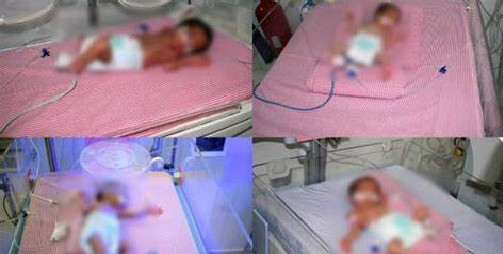 سيدة عشرينية تنجب 4 توائم إناث